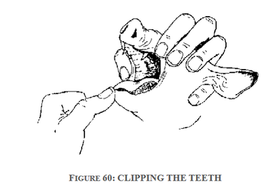 clipping the teeth 