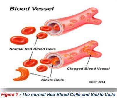 Blood vessel