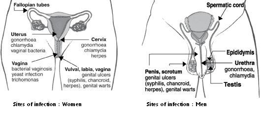 sites of infections 