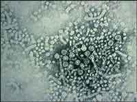 Hepatitis B Virus.jpg