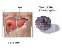 Liver cell death.jpg