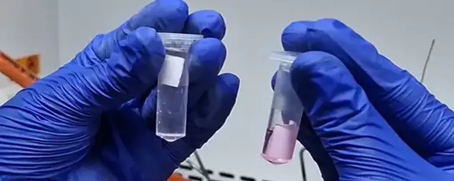 Urinary Antibiotic Susceptibility Test (U-AST) Kit | Vikaspedia - Health